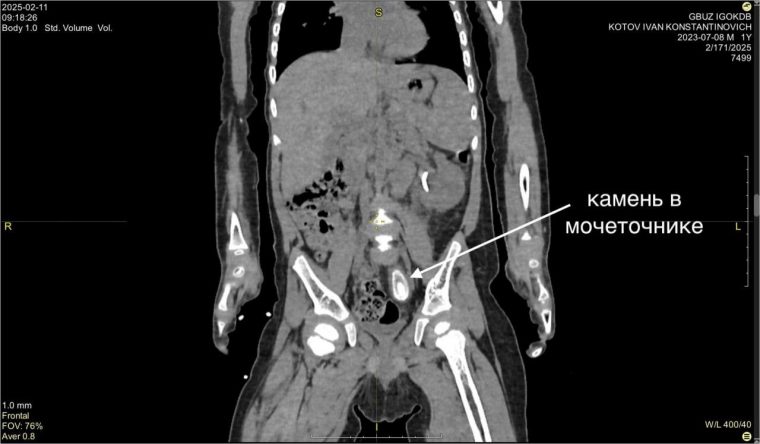 post-22771 thumbnail